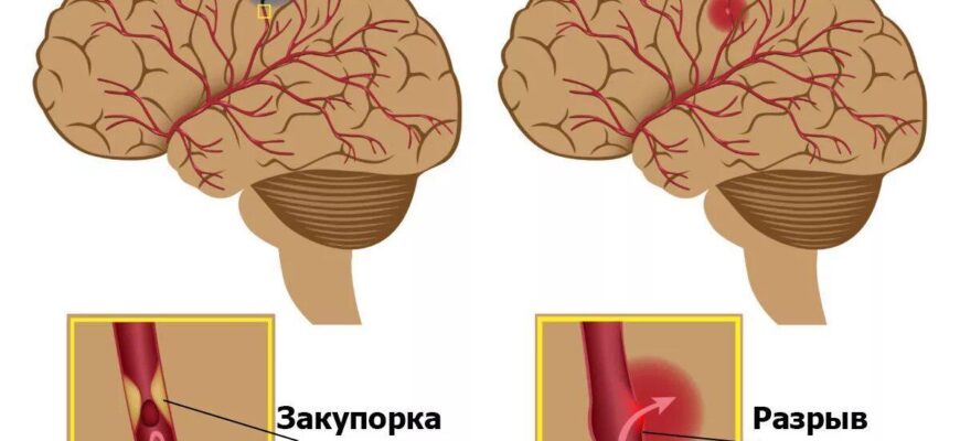 https://kyrgyzcha.site/?p=49686&preview=true